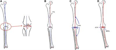 Early surgical outcomes and influencing factors of high tibial osteotomy